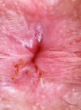 Massive Hairy Pussy In See-Through Panty Gallery