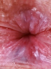 Pink Lingerie Teen Showing Hairy Pussy Gallery